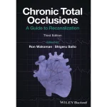 Chronic Total Occlusions A Guide to Recanalization