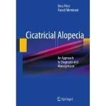 Cicatricial Alopecia An Approach to Diagnosis and Management