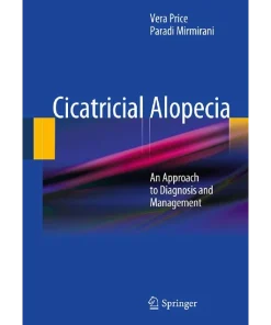 Cicatricial Alopecia An Approach to Diagnosis and Management