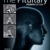 Academic Press The Pituitary