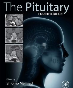 Academic Press The Pituitary