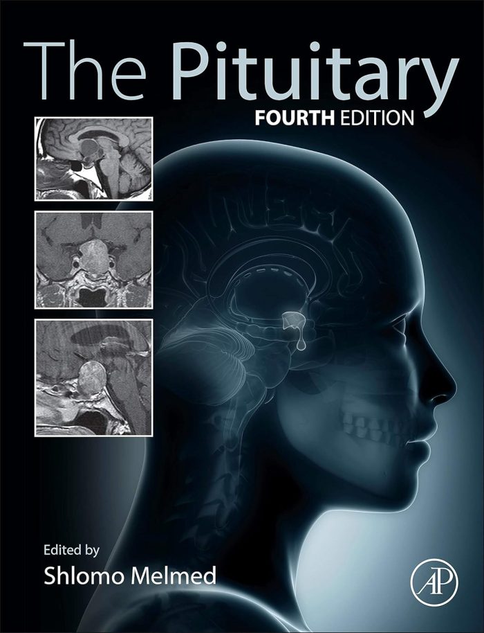 Academic Press The Pituitary