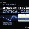 Hirsch and Brenner's Atlas of EEG in Critical Care