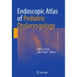 Endoscopic Atlas of Pediatric Otolaryngology