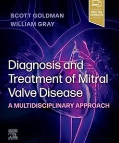 Diagnosis and Treatment of Mitral Valve Disease A Multidisciplinary Approach
