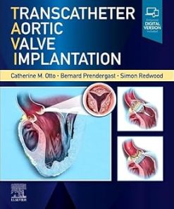 Transcatheter Aortic Valve Implantation
