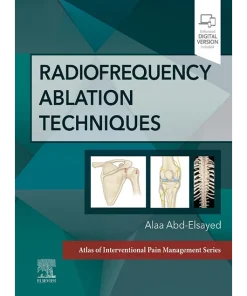 Radiofrequency Ablation Techniques