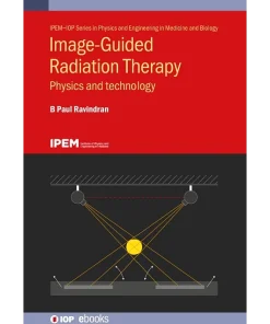 Image-Guided Radiation Therapy Physics and technolog