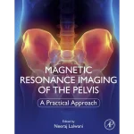Magnetic Resonance Imaging of The Pelvis A Practical Approach