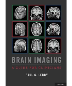Brain Imaging A Guide for Clinicians