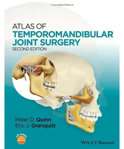 WILEY Atlas of Temporomandibular Joint Surgery