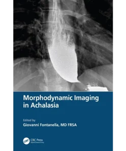 Morphodynamic Imaging in Achalasia