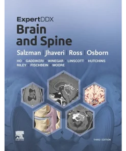 ExpertDDx Brain and Spine