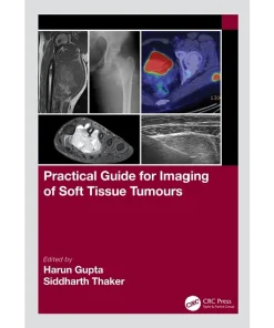 CRC Press Practical Guide for Imaging of Soft Tissue Tumours