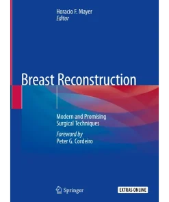 Breast Reconstruction Modern and Promising Surgical Techniques