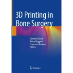 3D Printing in Bone Surgery