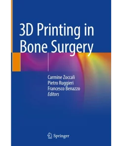 3D Printing in Bone Surgery