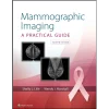 Mammographic Imaging