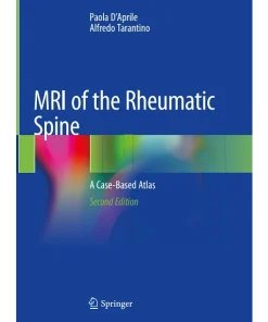 MRI of the Rheumatic Spine