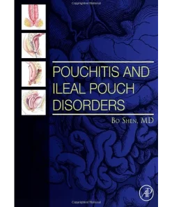 Pouchitis and Ileal Pouch Disorders