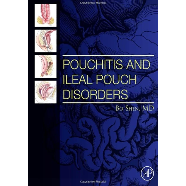 Pouchitis and Ileal Pouch Disorders