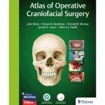 Atlas of Operative Craniofacial Surgery
