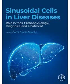 Sinusoidal Cells in Liver Diseases