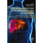 Safe Major Hepatectomy After Preoperative Liver Regeneration