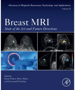 Breast MRI State of the Art and Future Directions