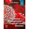 Treatment and Management of Tropical Liver Disease