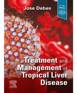 Treatment and Management of Tropical Liver Disease