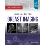 Breast Imaging The Core Requisites