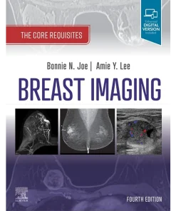 Breast Imaging The Core Requisites