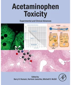Acetaminophen Toxicity Experimental and Clinical Advances