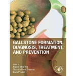 Gallstone Formation Diagnosis Treatment and Prevention