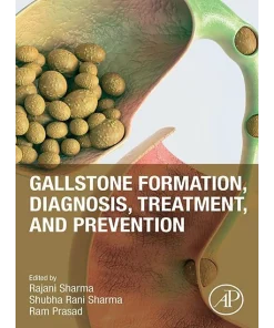 Gallstone Formation Diagnosis Treatment and Prevention