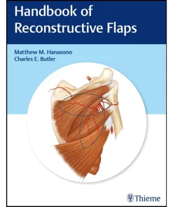 Handbook of Reconstructive Flaps