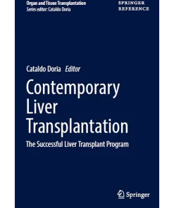 Contemporary Liver Transplantation