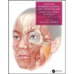 Calcium Hydroxylapatite Soft Tissue Fillers Expert Treatment Techniques