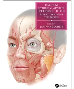 Calcium Hydroxylapatite Soft Tissue Fillers Expert Treatment Techniques