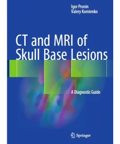 CT and MRI of Skull Base Lesions A Diagnostic Guide