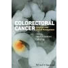 Colorectal Cancer Diagnosis and Clinical Management