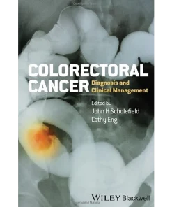 Colorectal Cancer Diagnosis and Clinical Management