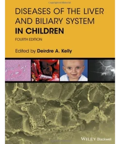 Diseases of the Liver and Biliary System in Children
