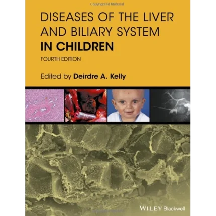 Diseases of the Liver and Biliary System in Children