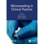 Microneedling in Clinical Practice