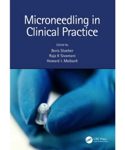 Microneedling in Clinical Practice