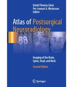 Atlas of Postsurgical Neuroradiology