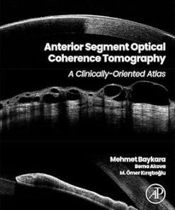 Anterior Segment Optical Coherence Tomography