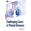 Challenging Cases in Pleural Diseases